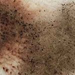 What is Flea Dirt